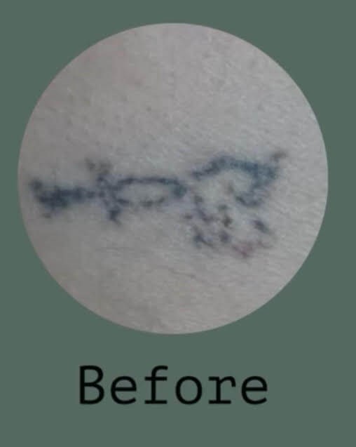 Before Image