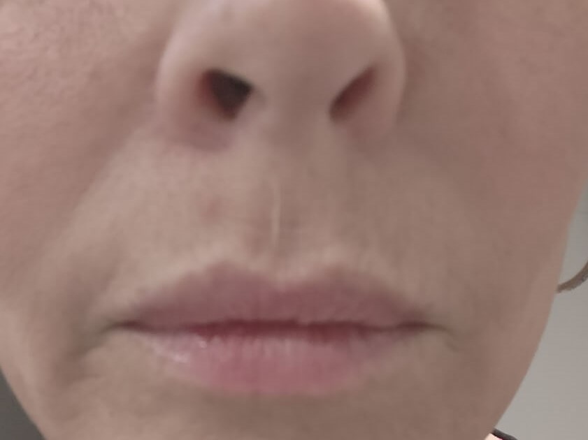 Before Image