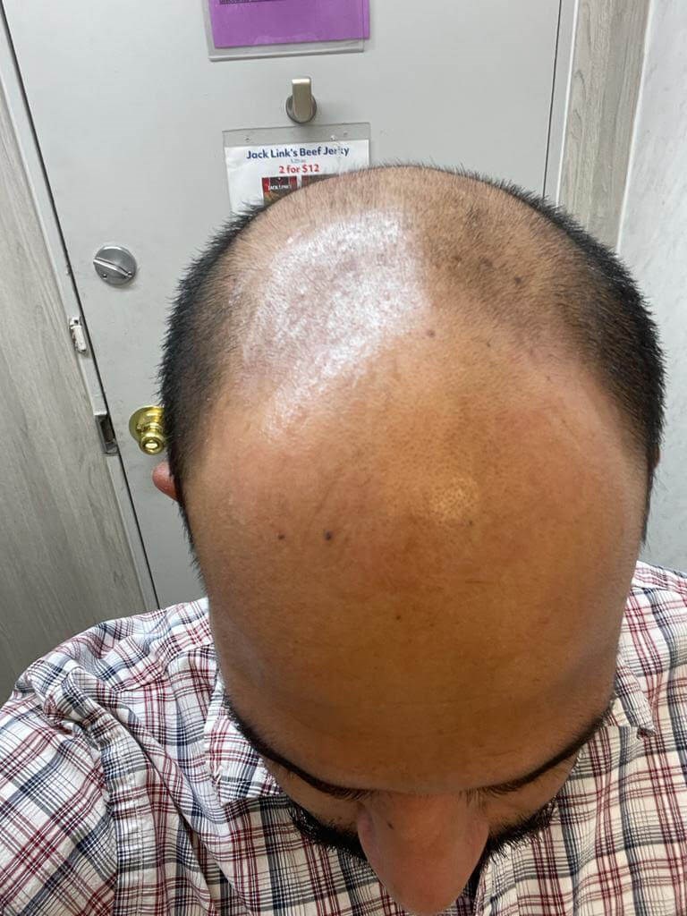 Before Image