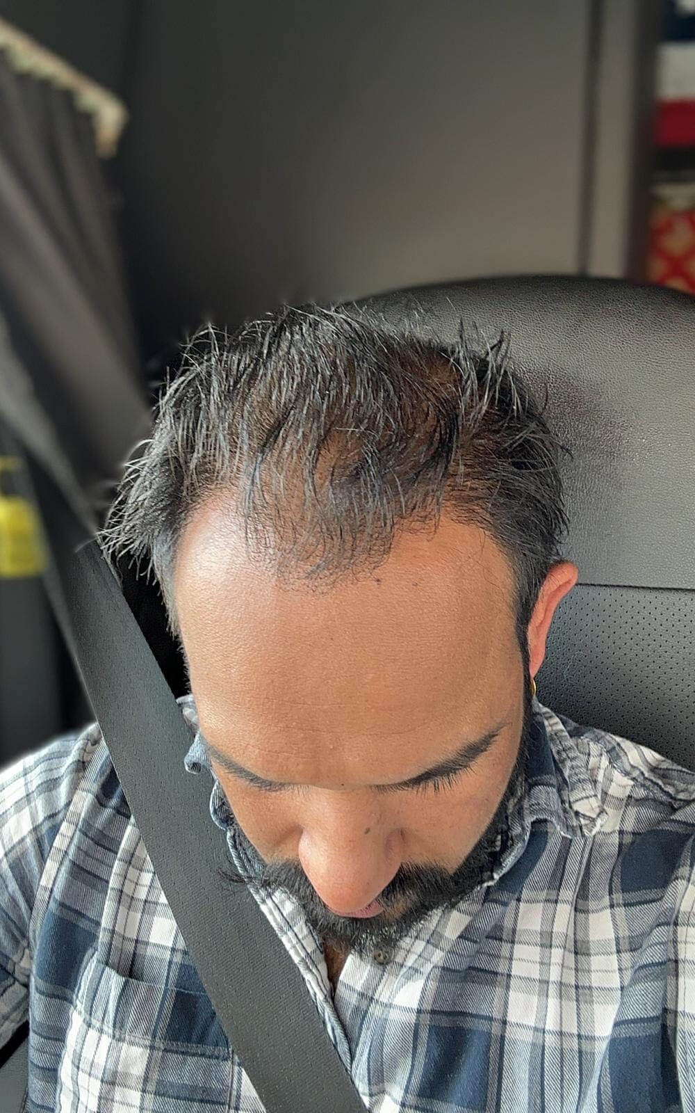 After Image