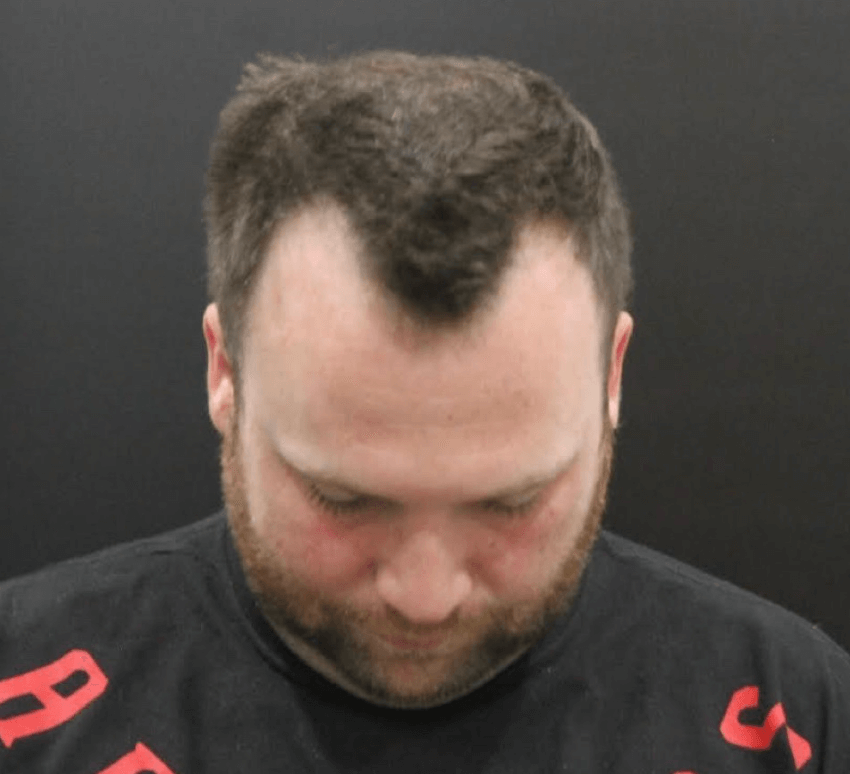 Before Image