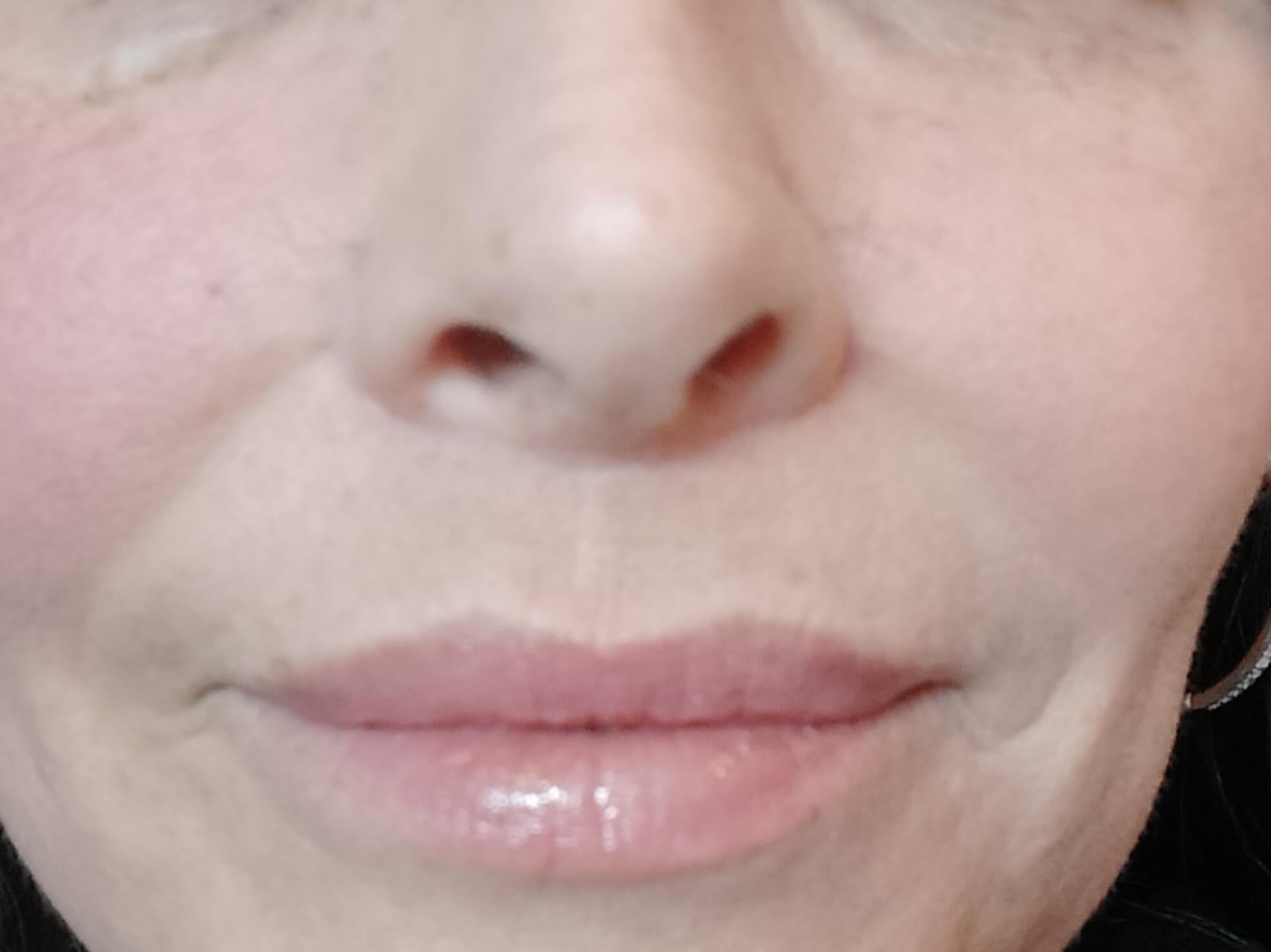 Lip Flip After