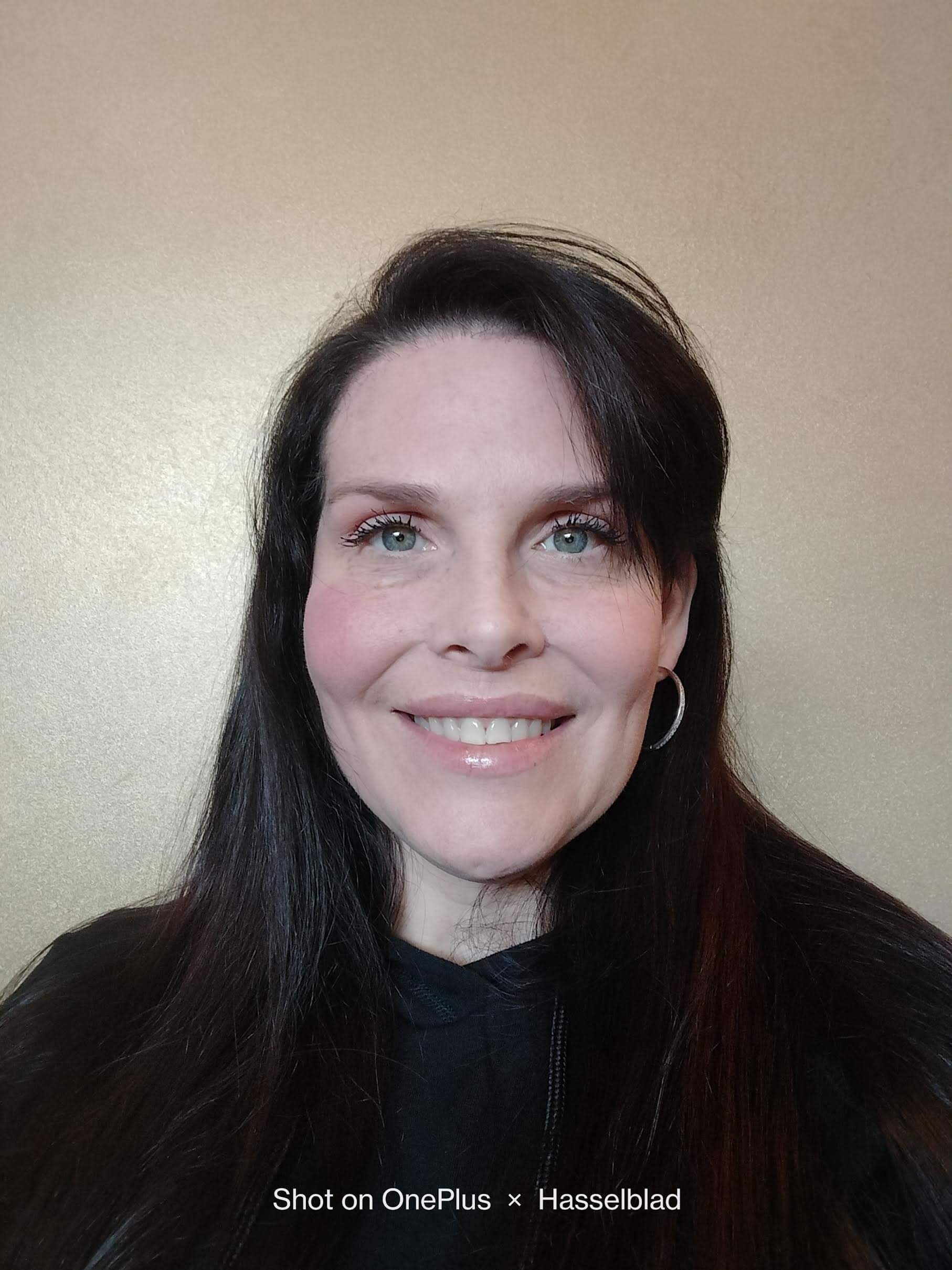 FOREHEAD REDUCTION SURGERY After
