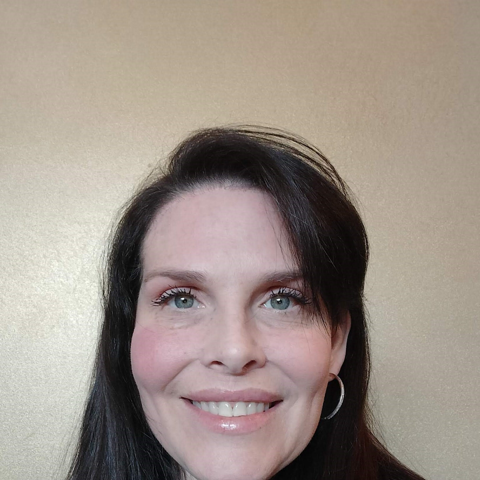 Forehead Reduction Surgery AFT