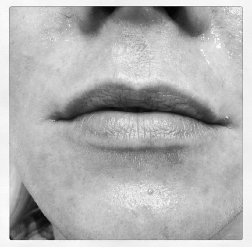 Before Image